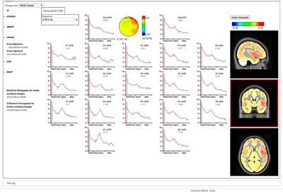 A Quantitative EEG Toolbox for the MNI Neuroinformatics Ecosystem: Normative SPM of EEG Source Spectra